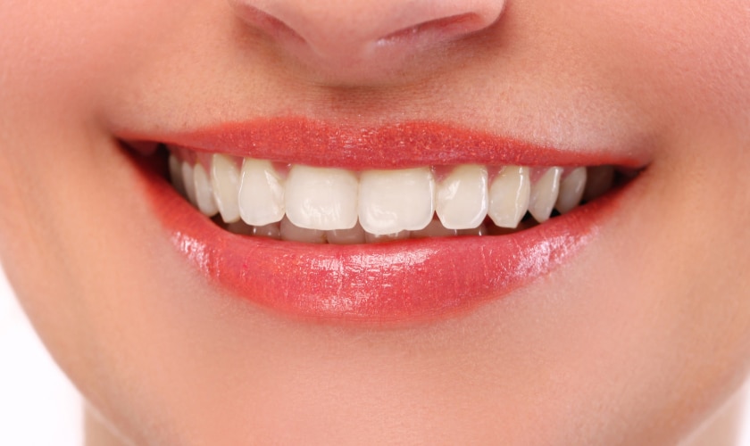 Teeth Whitening in Riverside - Inland Choice Dental