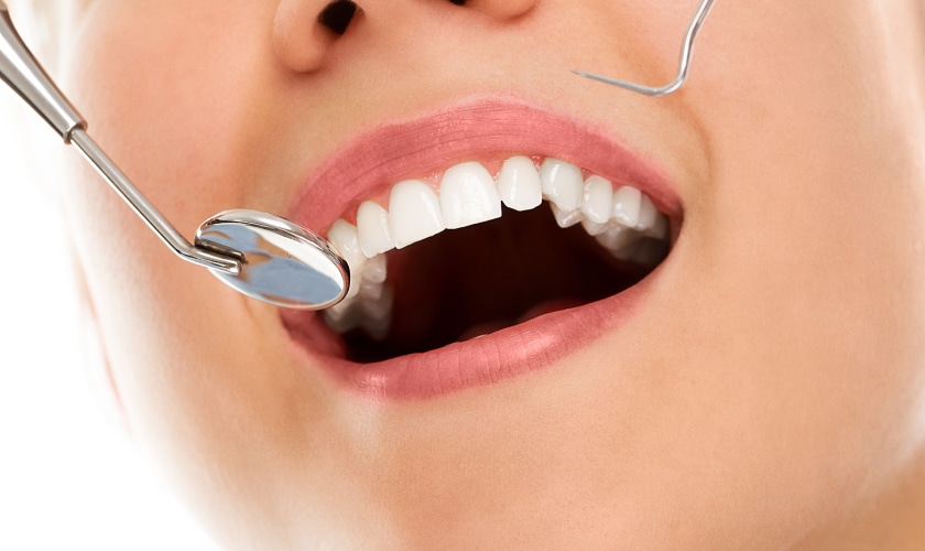 healthy teeth - Inland Choice Dental - Dentist in Riverside