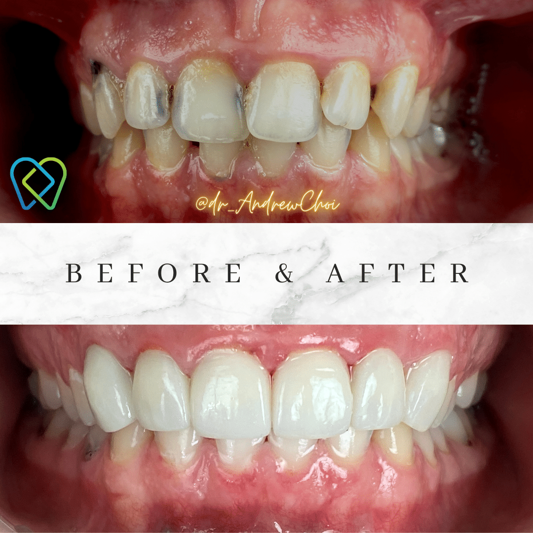 Before and after Dentist Riverside