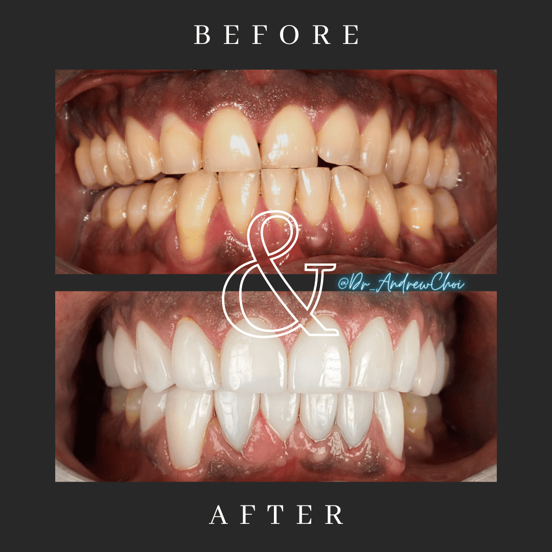 Before and after Dentist Riverside