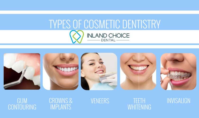 Featured image for “What is cosmetic dentistry and its various treatment methods?”