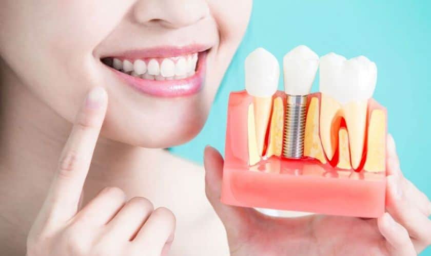 Featured image for “Regain Your Radiant Smile With Dental Implants Today!”