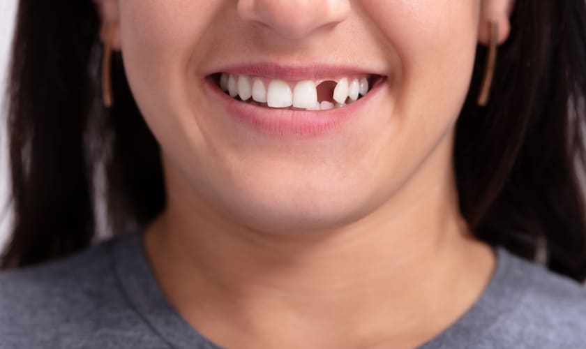 missing teeth? dental implant in riverside, ca | Inland choice dental