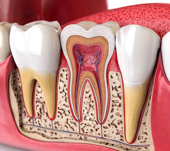 Root Canals in Riverside | Inland choice Dental