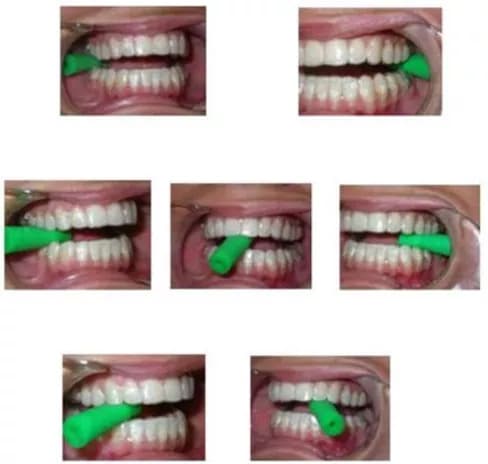 Invisalign Dentist in Riverside, CA 20Chewies 20Instructions