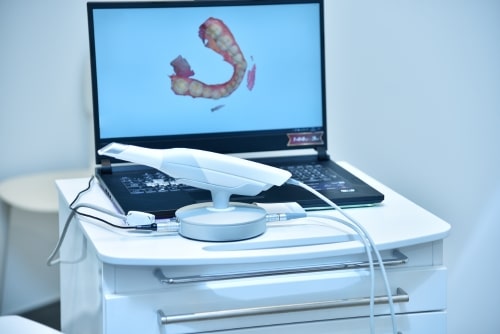 Itero® Element 5D Scanner in riverside CA | Inland Choice Dental - Riverside dentist
