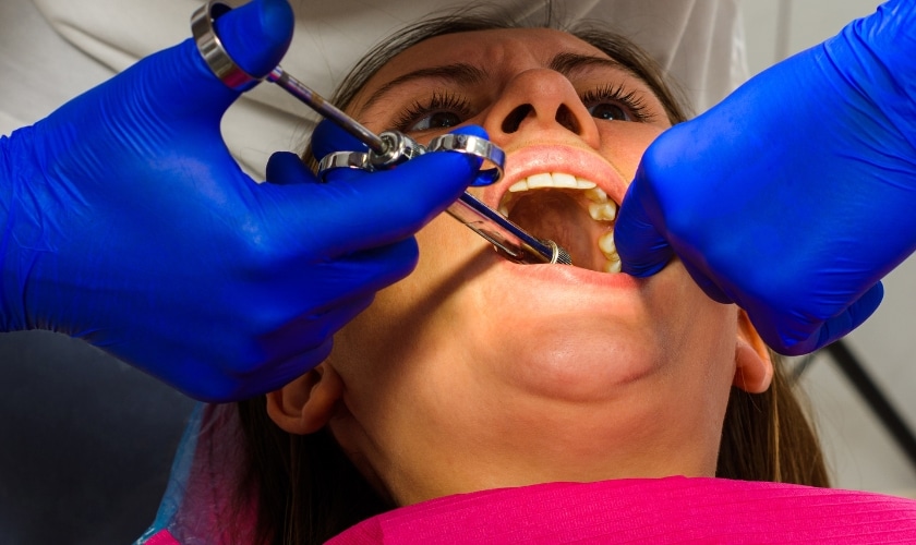 Local Anesthesia for Tooth Extraction in Riverside, CA