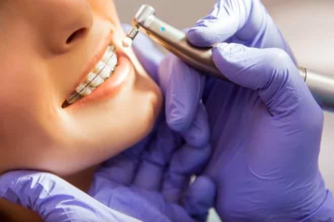 orthodontist in Riverside, CA | Inland Choice Dental - Riverside Dentist