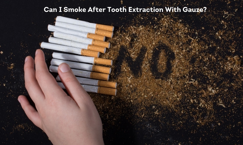 Can I Smoke After Tooth Extraction With Gauze?