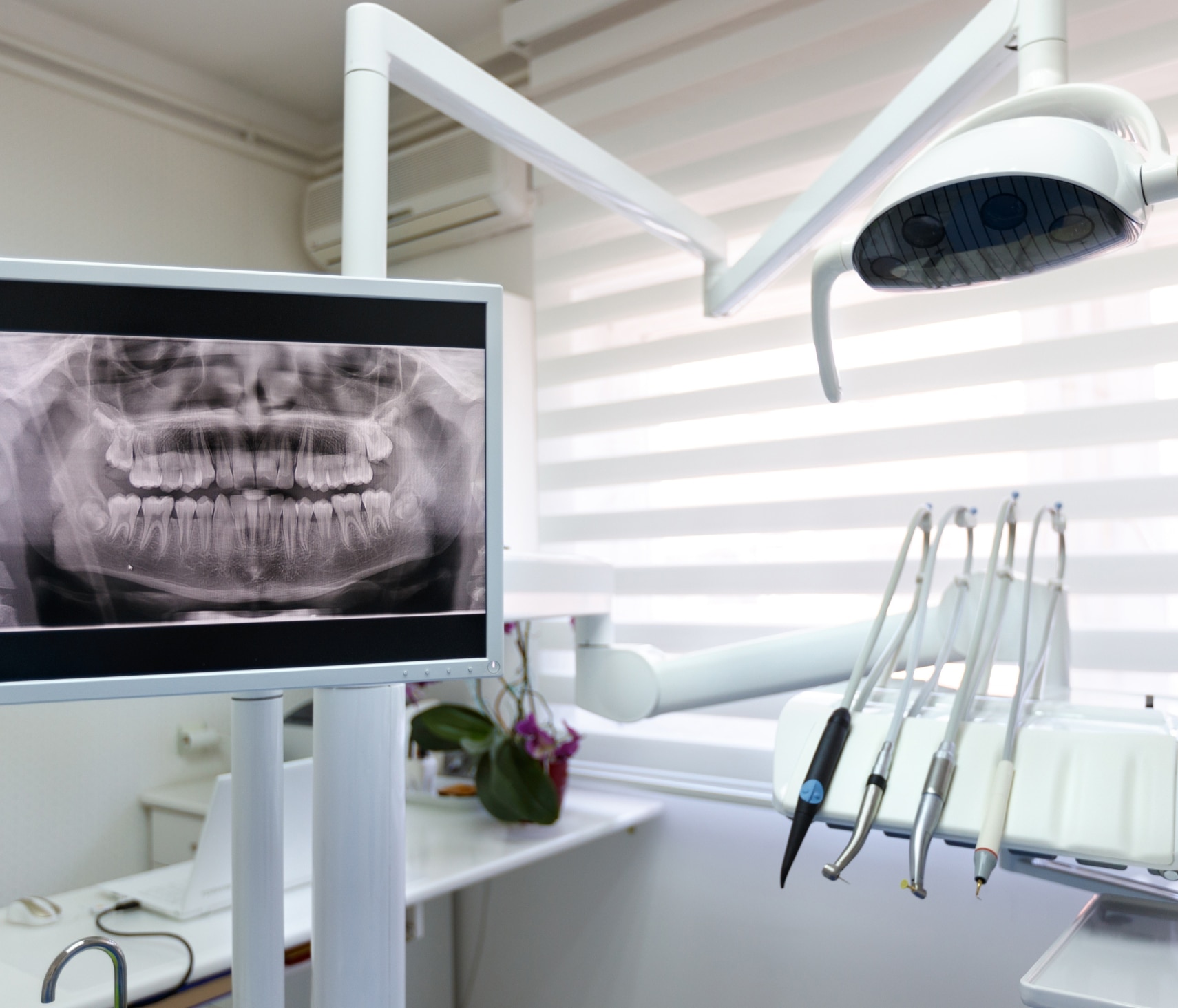 Uncover the Benefits: How Digital Dental X-Rays Improve Your Oral Health"