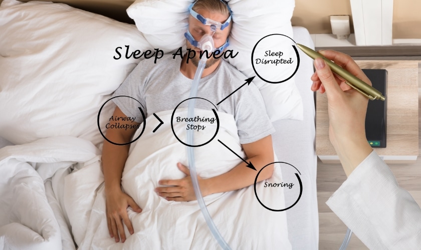 How Do You Fix Sleep Apnea Naturally