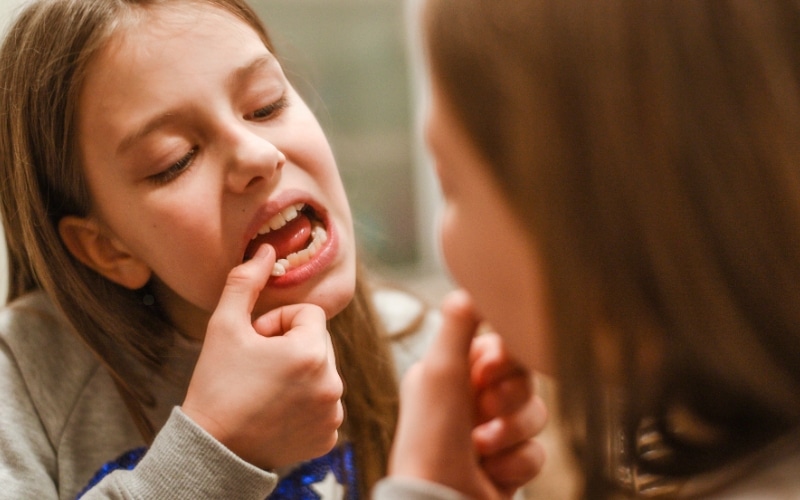 Featured image for “How Long Does It Take For A Loose Tooth To Tighten Back Up?”